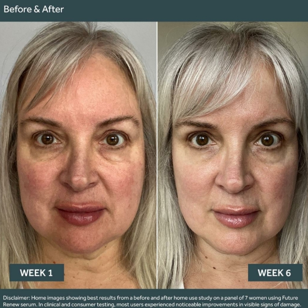 No7 FUTURE RENEW DAMAGE REVERSAL SERUM - Picture 6 of 8